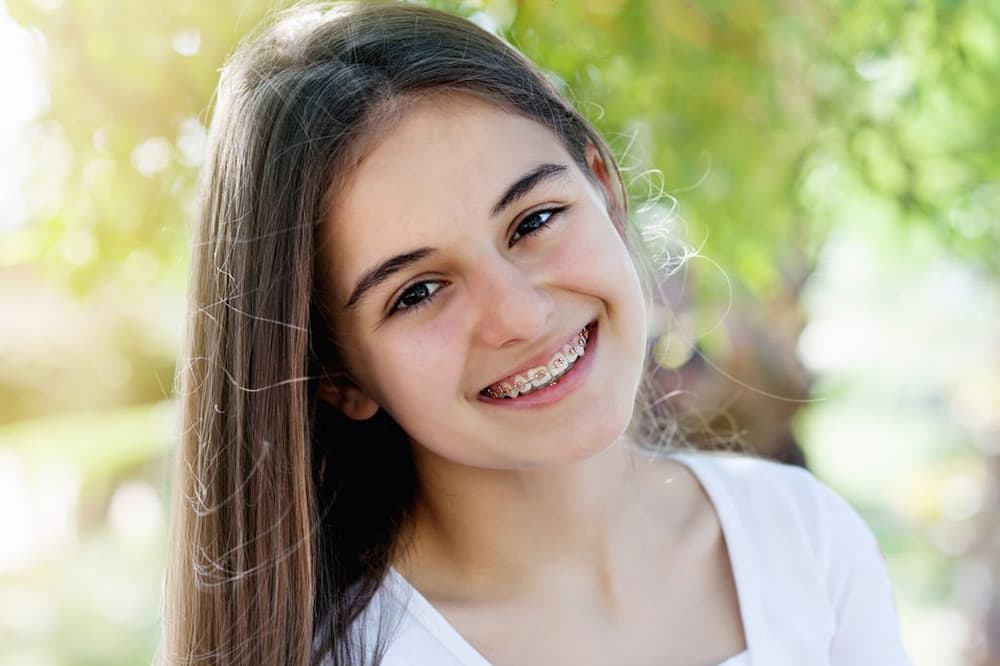 Aparelho dentário em Irecê